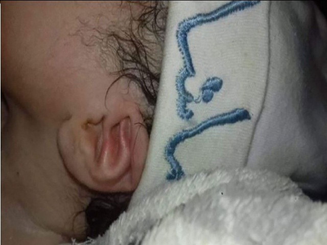 ولادة طفلة تحمل شكل لفظ الجلالة في أذنيها